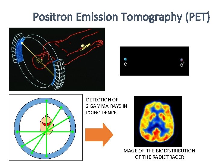 Positron Emission Tomography (PET) DETECTION OF 2 GAMMA RAYS IN COINCIDENCE IMAGE OF THE