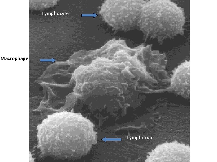 Lymphocyte Macrophage Lymphocyte 