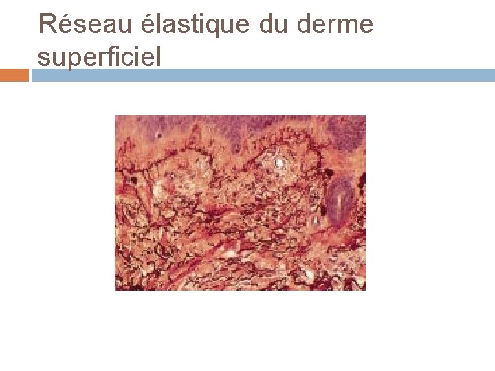 Réseau élastique du derme superficiel 