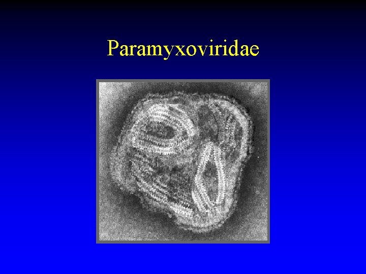 Paramyxoviridae 
