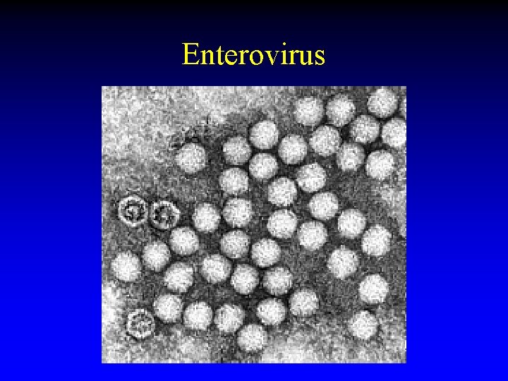 Enterovirus 