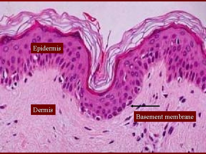 Epidermis Dermis Basement membrane 