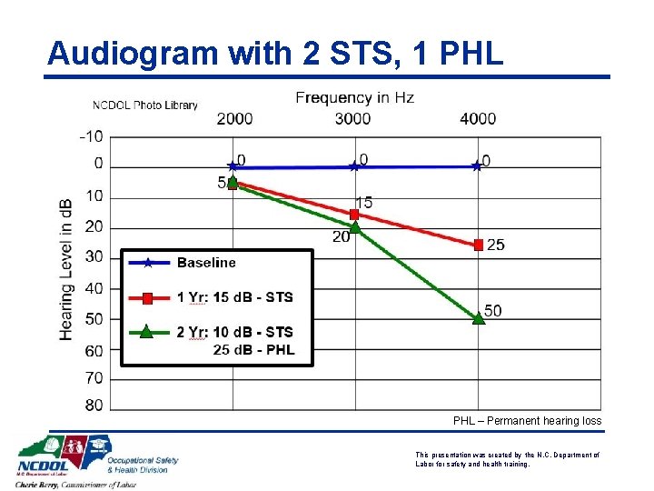 Audiogram with 2 STS, 1 PHL – Permanent hearing loss This presentation was created Audiogram with 2 STS, 1 PHL – Permanent hearing loss This presentation was created