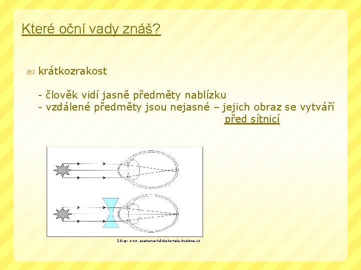 Které oční vady znáš? krátkozrakost - člověk vidí jasně předměty nablízku - vzdálené předměty