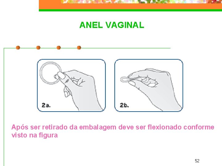 ANEL VAGINAL Após ser retirado da embalagem deve ser flexionado conforme visto na figura