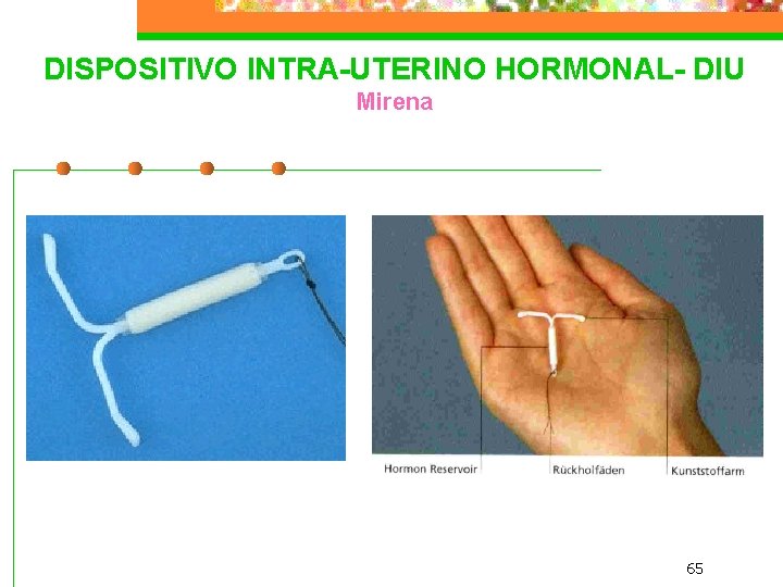 DISPOSITIVO INTRA-UTERINO HORMONAL- DIU Mirena 65 