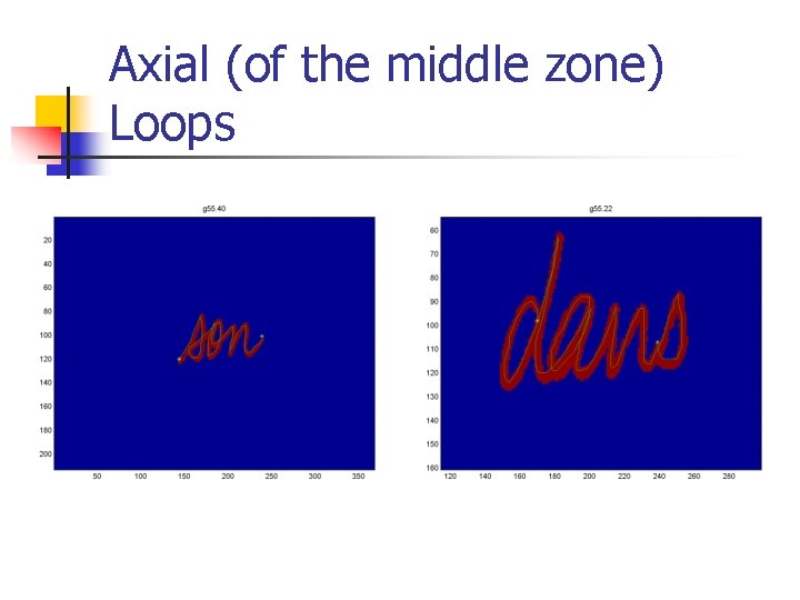 Axial (of the middle zone) Loops 