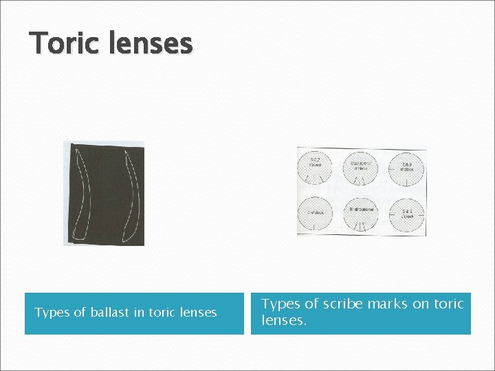 Toric lenses Types of ballast in toric lenses Types of scribe marks on toric