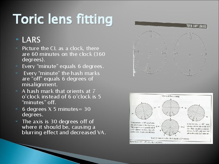 Toric lens fitting LARS Picture the CL as a clock, there are 60 minutes