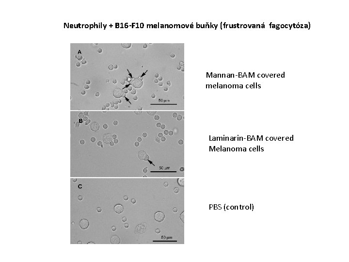 Neutrophily + B 16 -F 10 melanomové buňky (frustrovaná fagocytóza) Mannan-BAM covered melanoma cells