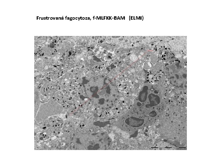 Frustrovaná fagocytoza, f-MLFKK-BAM (ELMI) 