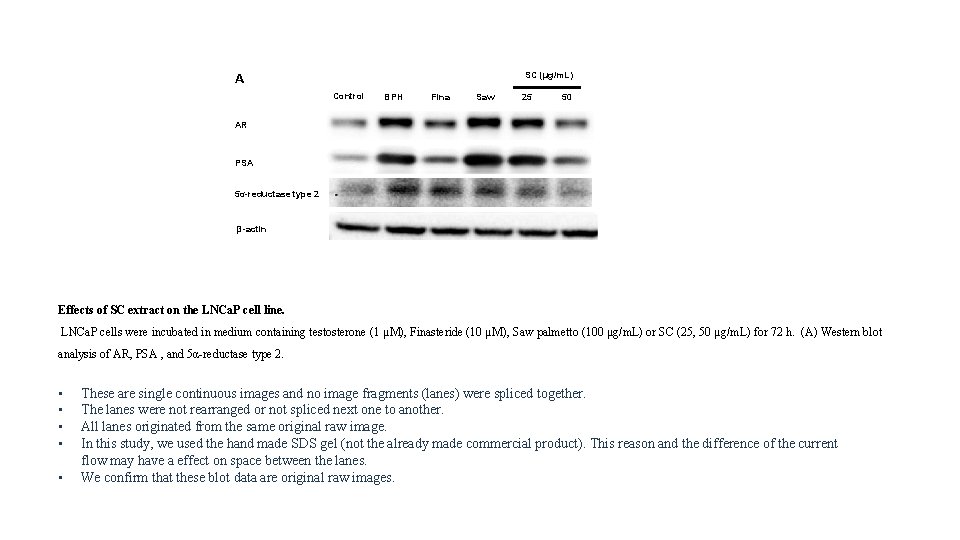 A SC (µg/m. L) Control BPH Fina Saw 25 50 AR PSA 5α-reductase type