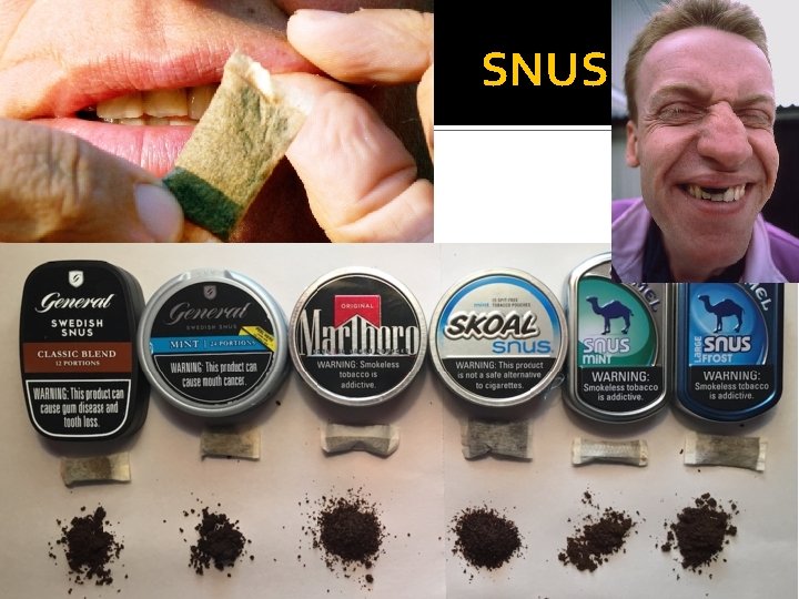 SNUS 