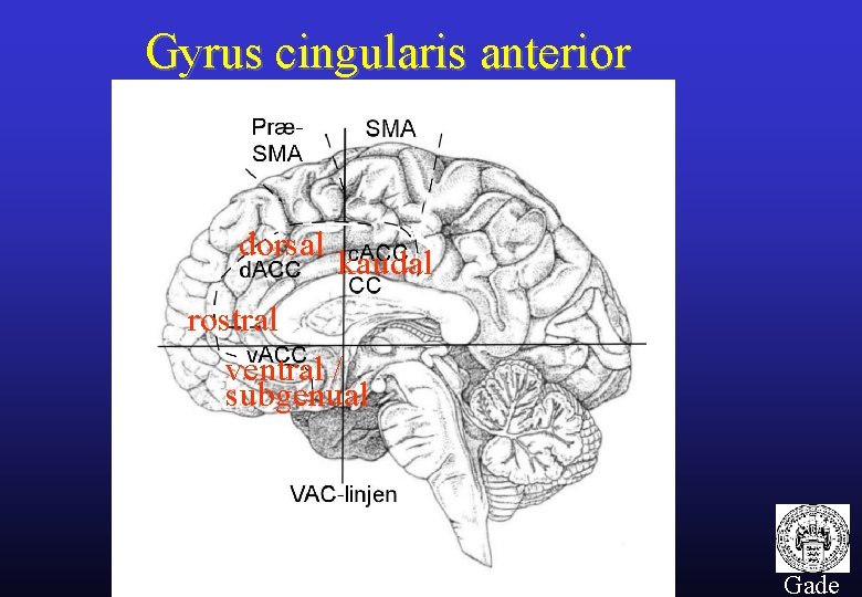 Gyrus cingularis anterior dorsal kaudal rostral ventral / subgenual 12 Gade 