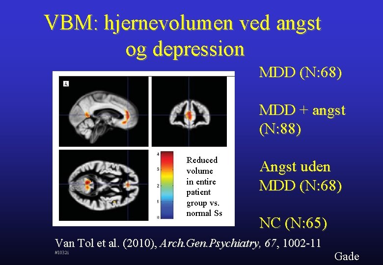 VBM: hjernevolumen ved angst og depression MDD (N: 68) MDD + angst (N: 88)
