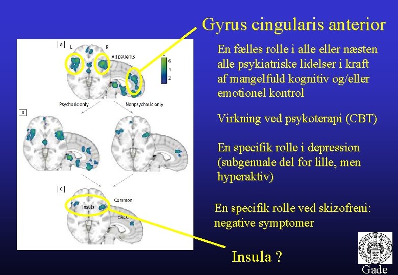 Gyrus cingularis anterior En fælles rolle i alle eller næsten alle psykiatriske lidelser i