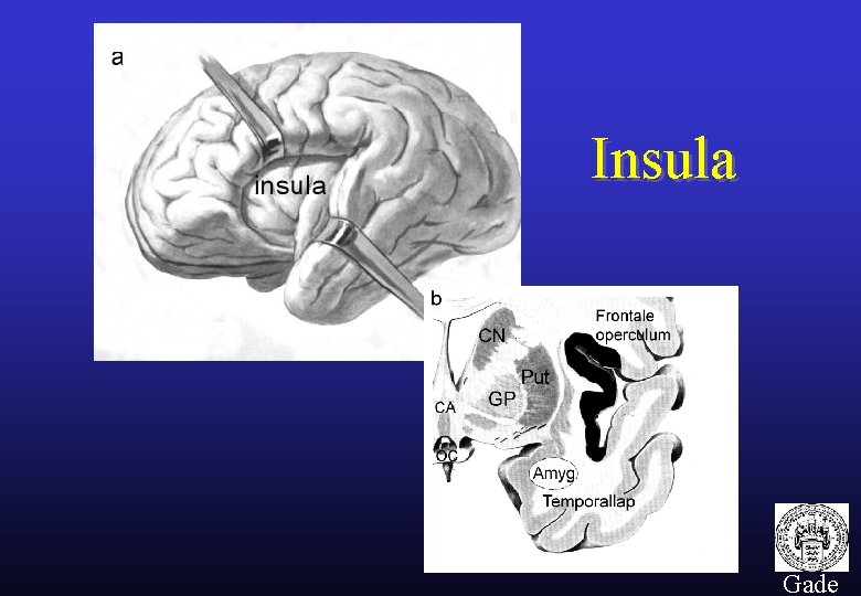 Insula 27 Gade 