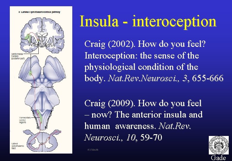 Insula - interoception Craig (2002). How do you feel? Interoception: the sense of the
