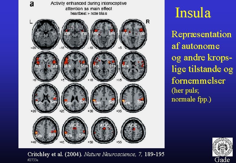 Insula Repræsentation af autonome og andre kropslige tilstande og fornemmelser (her puls; normale fpp.