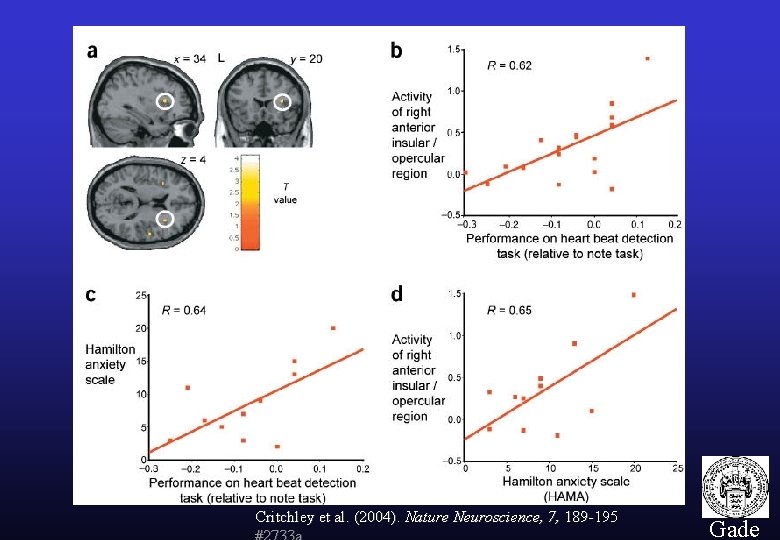 Critchley et al. (2004). Nature Neuroscience, 7, 189 -195 31 Gade 