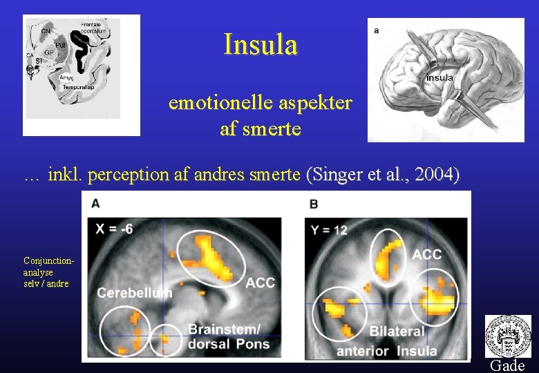 Insula emotionelle aspekter af smerte … inkl. perception af andres smerte (Singer et al.