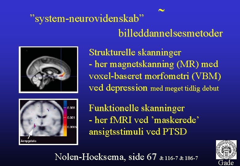 ˜ ”system-neurovidenskab” billeddannelsesmetoder Strukturelle skanninger - her magnetskanning (MR) med voxel-baseret morfometri (VBM) ved