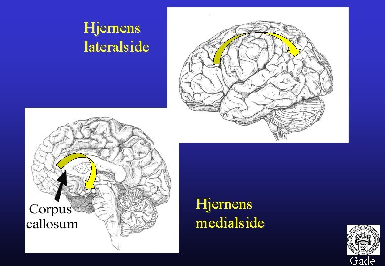 Hjernens lateralside Hjernens medialside 5 Gade 