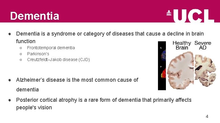 Dementia ● Dementia is a syndrome or category of diseases that cause a decline