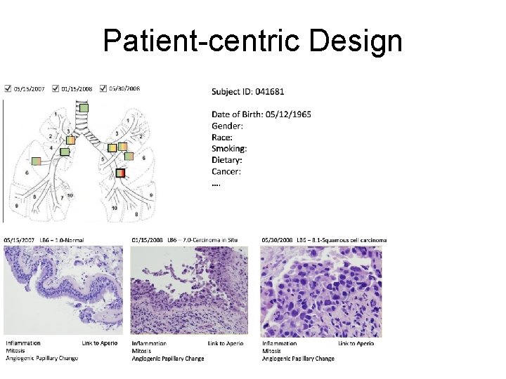 Patient-centric Design 