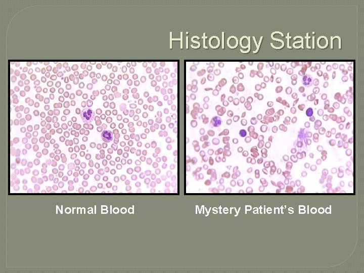 Histology Station Normal Blood Mystery Patient’s Blood 