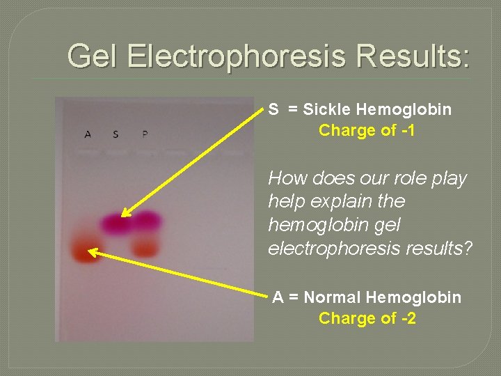 Gel Electrophoresis Results: S = Sickle Hemoglobin Charge of -1 How does our role