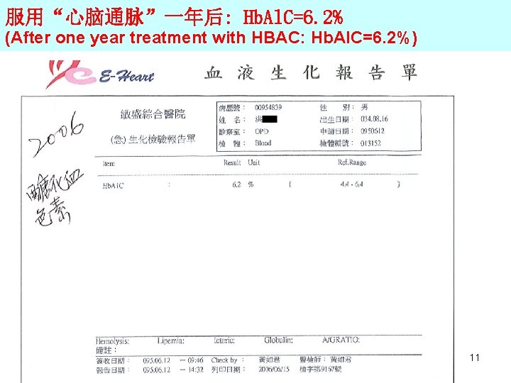 服用“心脑通脉”一年后: Hb. Al. C=6. 2% (After one year treatment with HBAC: Hb. Al. C=6.