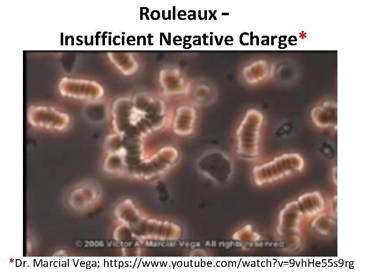 Rouleaux – Insufficient Negative Charge* *Dr. Marcial Vega; https: //www. youtube. com/watch? v=9 vh.