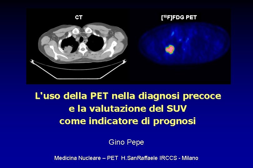 CT [18 F]FDG PET L'uso della PET nella diagnosi precoce e la valutazione del