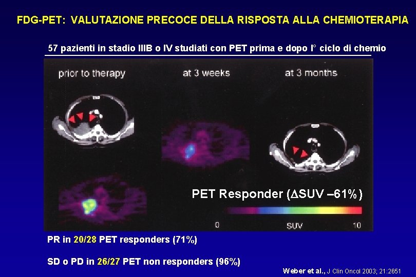 FDG-PET: VALUTAZIONE PRECOCE DELLA RISPOSTA ALLA CHEMIOTERAPIA 57 pazienti in stadio IIIB o IV