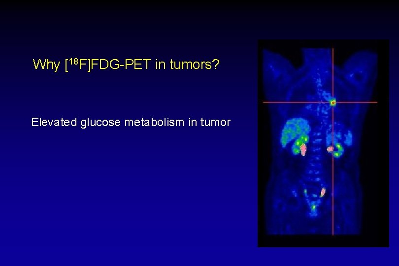 Why [18 F]FDG-PET in tumors? Elevated glucose metabolism in tumor 