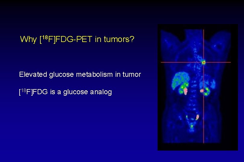 Why [18 F]FDG-PET in tumors? Elevated glucose metabolism in tumor [18 F]FDG is a