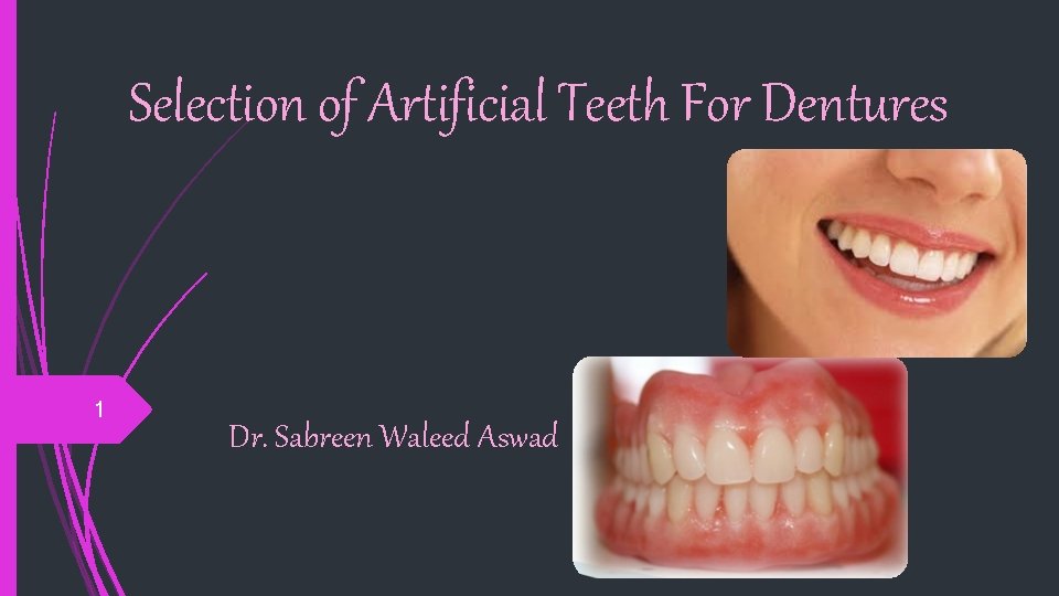 Selection of Artificial Teeth For Dentures 1 Dr. Sabreen Waleed Aswad 