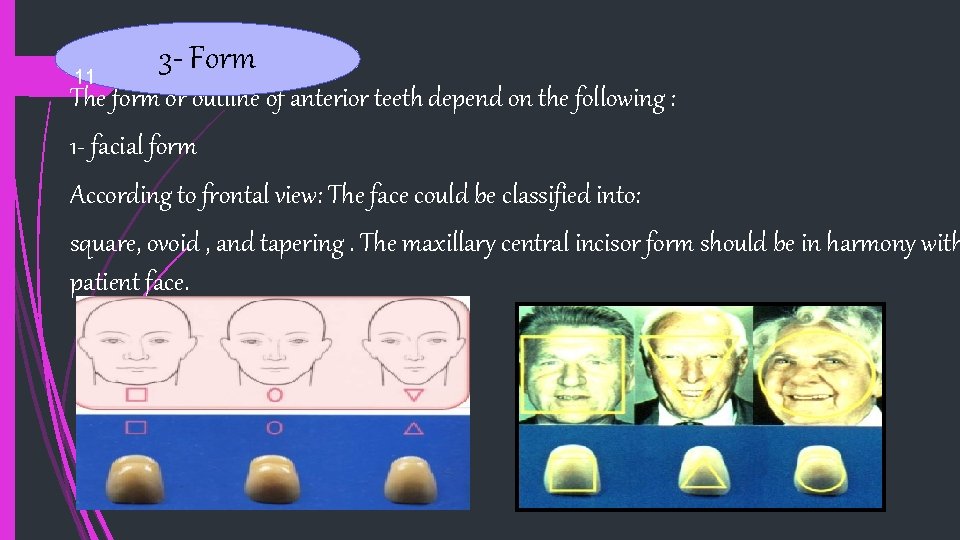 11 3 - Form The form or outline of anterior teeth depend on the