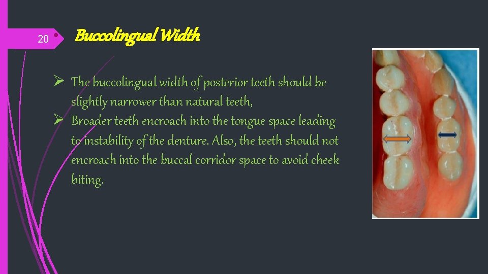 20 • Buccolingual Width Ø The buccolingual width of posterior teeth should be slightly