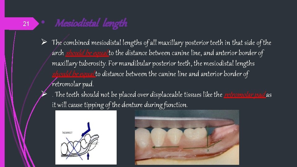 21 • Mesiodistal length Ø The combined mesiodistal lengths of all maxillary posterior teeth