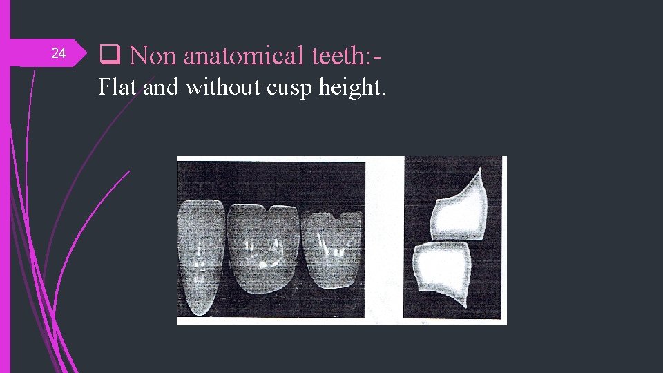 24 q Non anatomical teeth: Flat and without cusp height. 