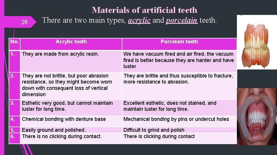 Materials of artificial teeth 26 No. There are two main types, acrylic and porcelain