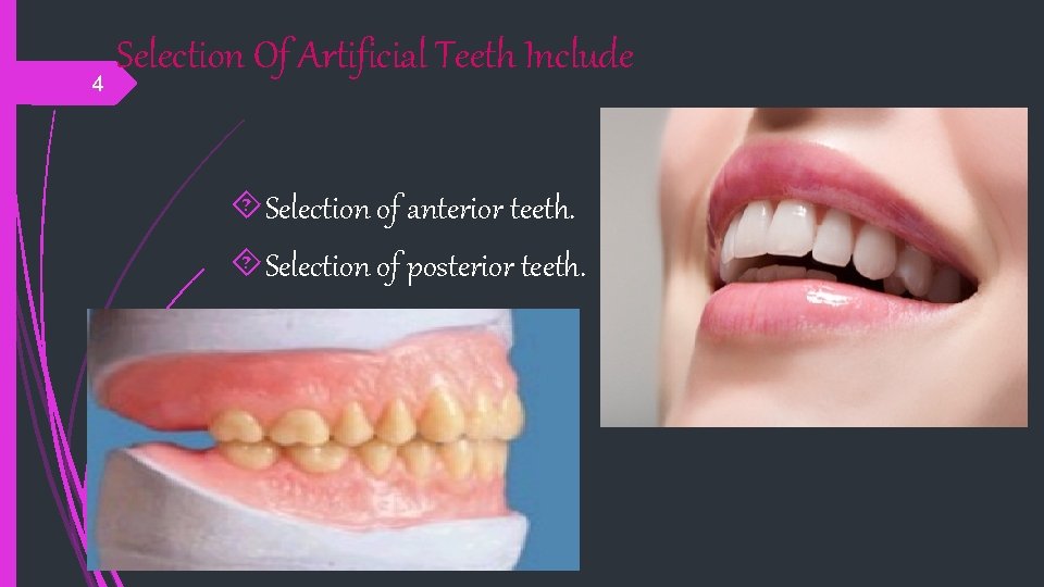 Selection Of Artificial Teeth Include 4 Selection of anterior teeth. Selection of posterior teeth.