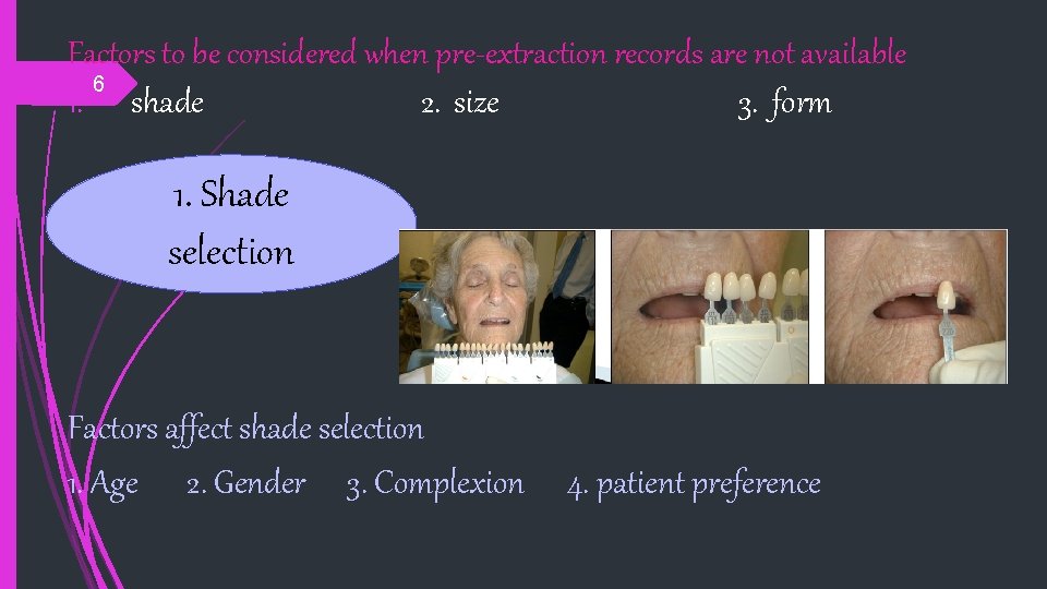 Factors to be considered when pre-extraction records are not available 6 1. shade 2.