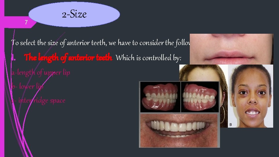 7 2 -Size To select the size of anterior teeth, we have to consider