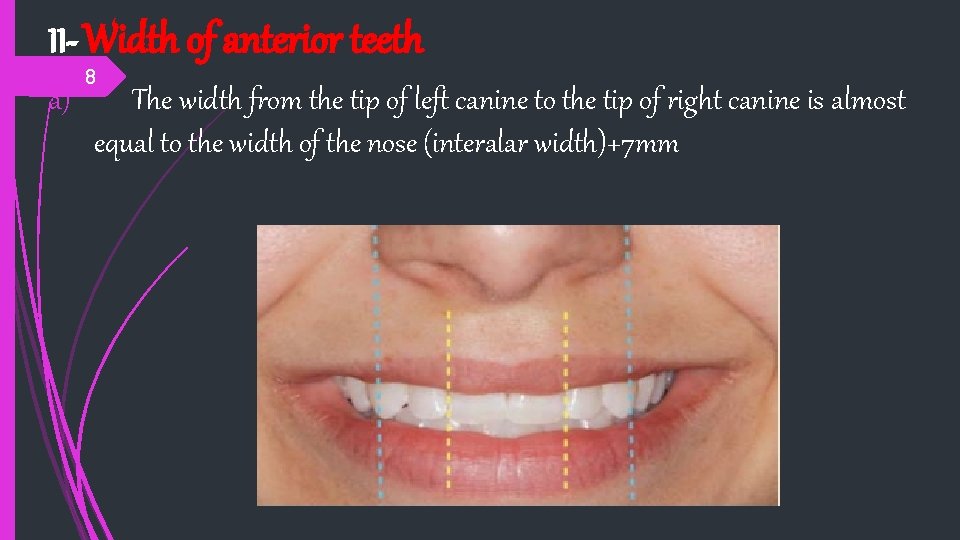 II- Width of anterior teeth a) 8 The width from the tip of left