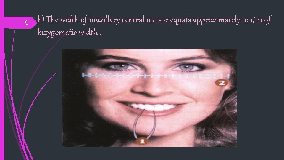 9 b) The width of maxillary central incisor equals approximately to 1/16 of bizygomatic