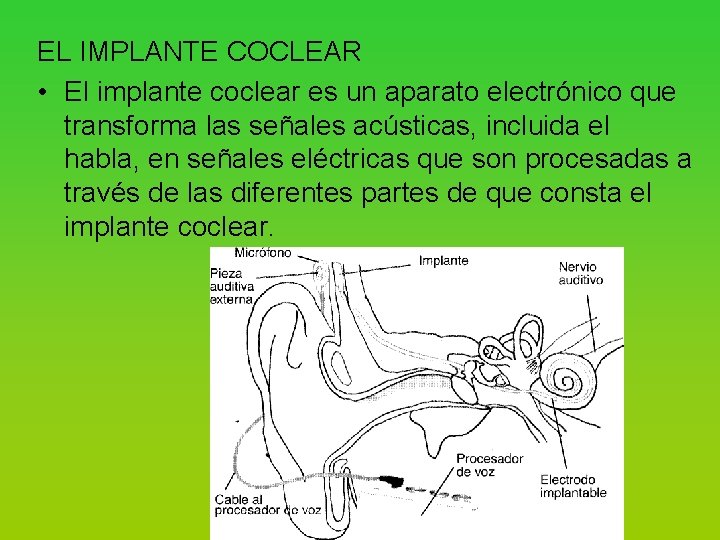 EL IMPLANTE COCLEAR • El implante coclear es un aparato electrónico que transforma las