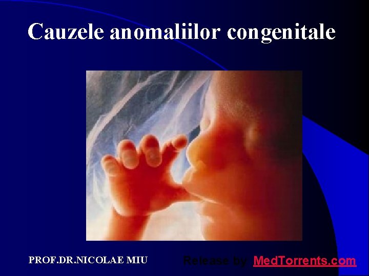 Cauzele anomaliilor congenitale PROF. DR. NICOLAE MIU Release by Med. Torrents. com 